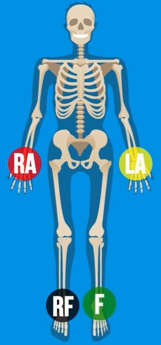  Cara  Pemasangan  Lead EKG  pada Pasien Info Alat Kedokteran