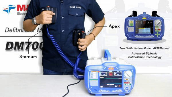 Defibrilator adalah alat medis yang akan memberikan sengatan listrik bertegangan tinggi untuk memulihkan dan menstabilkan ritme normal jantung.