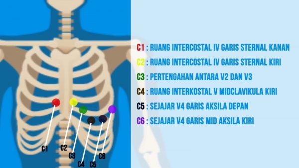 Distributor Alat Kedokteran Indonesia