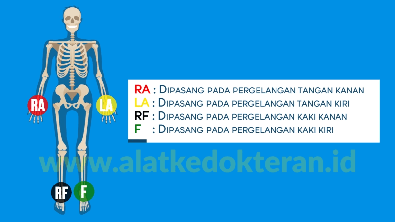  pemasangan  limb Distributor Alat Kedokteran Indonesia