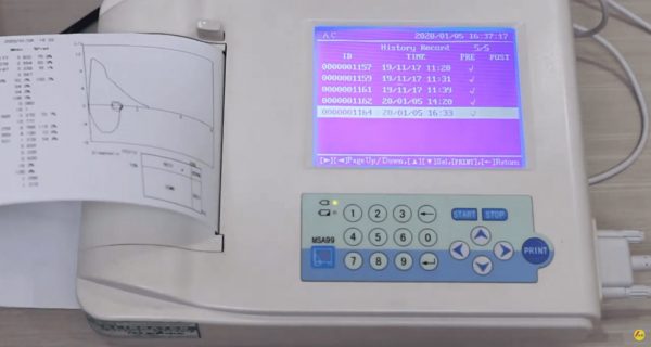 Spirometer adalah alat yang digunakan untuk mengukur seberapa baik fungsi paru - paru pasien dan dapat mencatat serta menampilkannya dalam bentuk grafik.