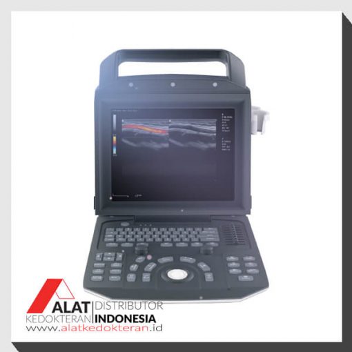 Jual USG Color Doppler 2D Portable Zoncare-M5