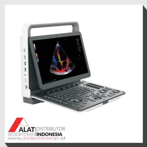 Jual USG portable 3D dan 4D Zoncare M50